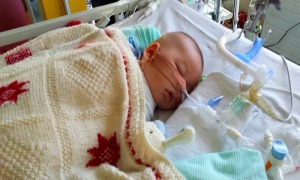 Alistair in the PICU.